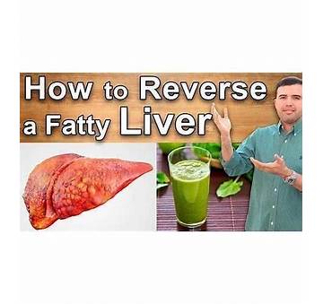 How To Burn Liver Fat